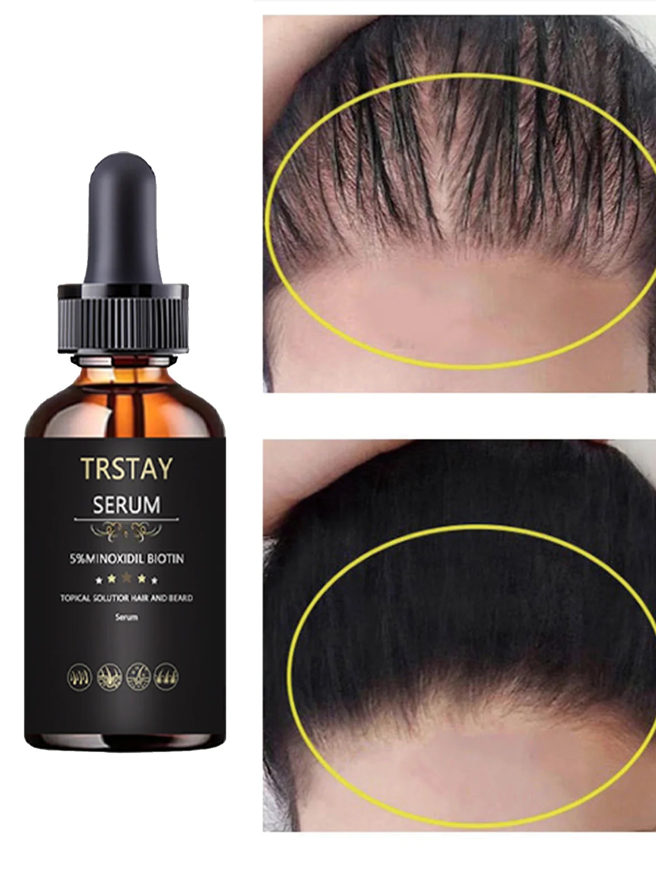 Aceite Esencial Capilar Hidratante - Fortalece, Elasticidad y Volumen