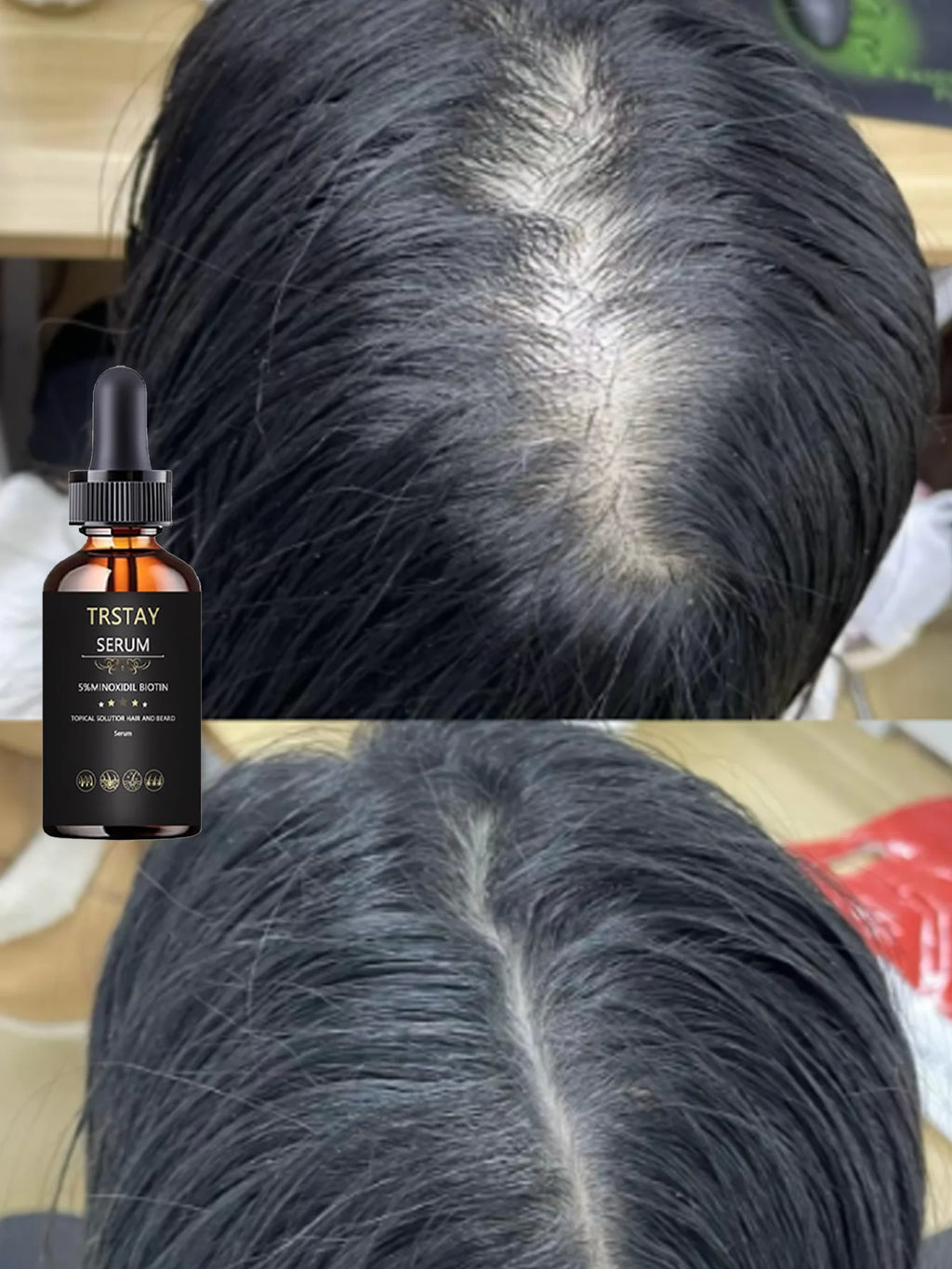 Aceite Esencial Capilar Hidratante - Fortalece, Elasticidad y Volumen