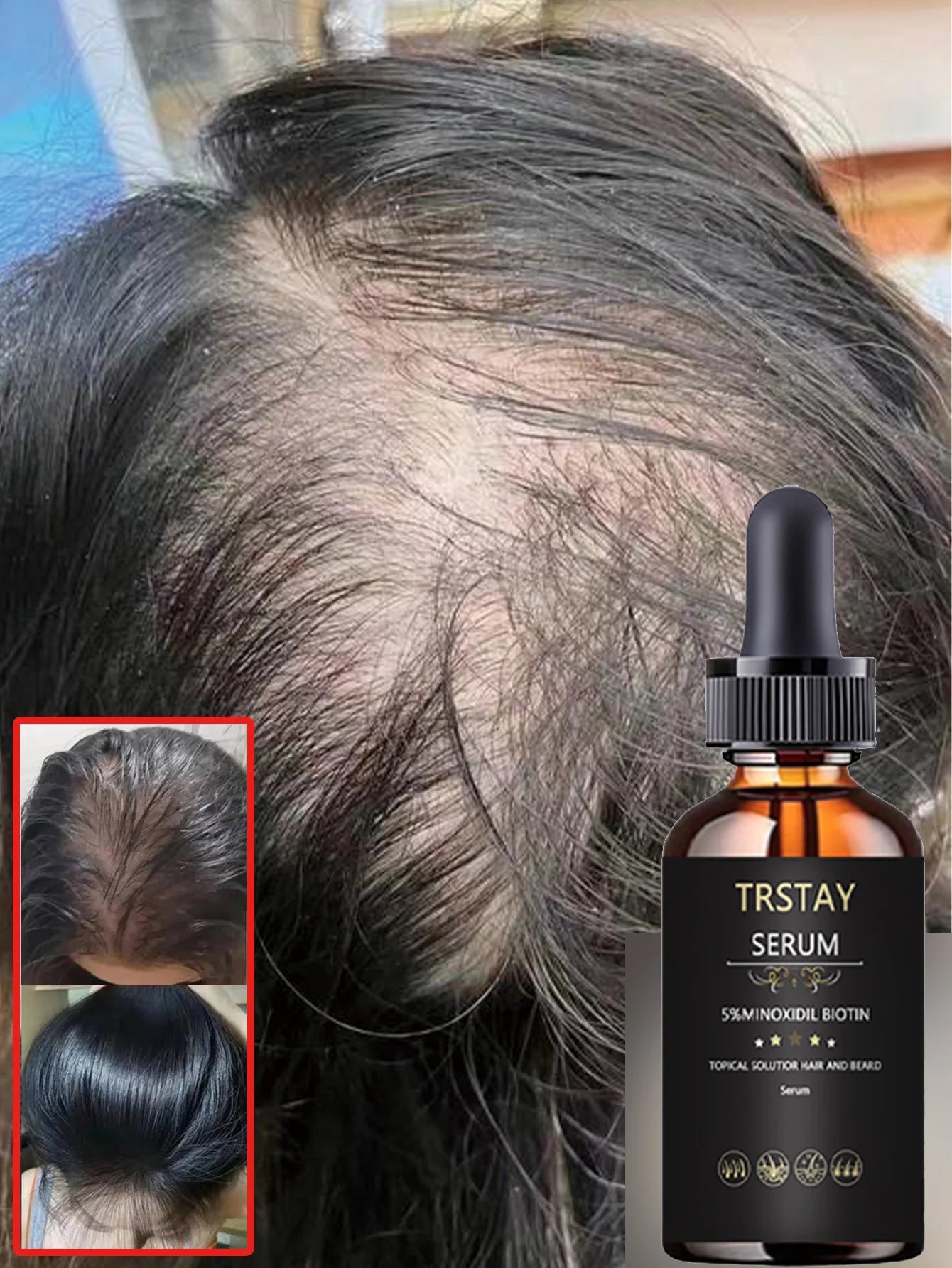 Aceite Esencial Capilar Hidratante - Fortalece, Elasticidad y Volumen