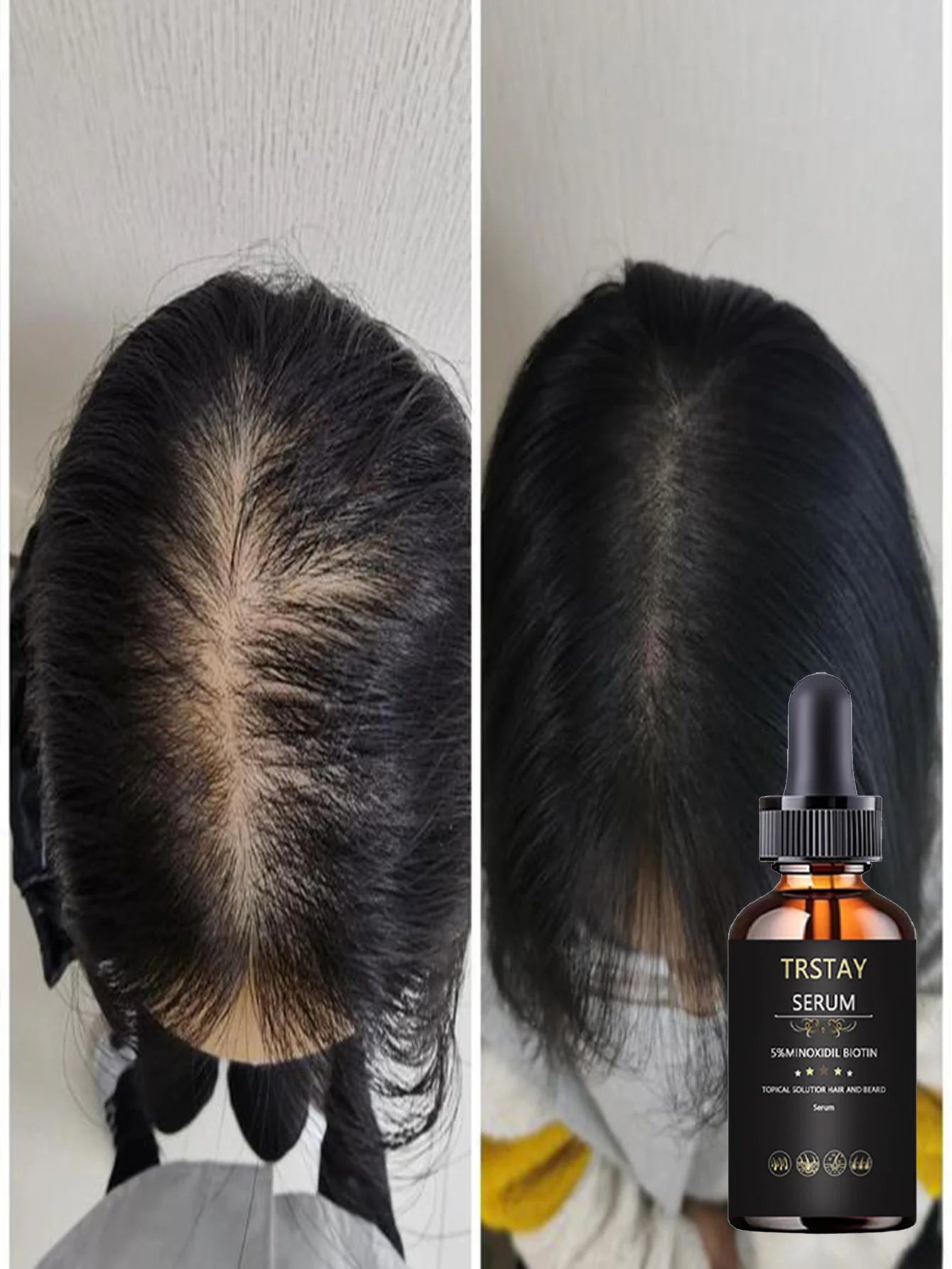 Aceite Esencial Capilar Hidratante - Fortalece, Elasticidad y Volumen