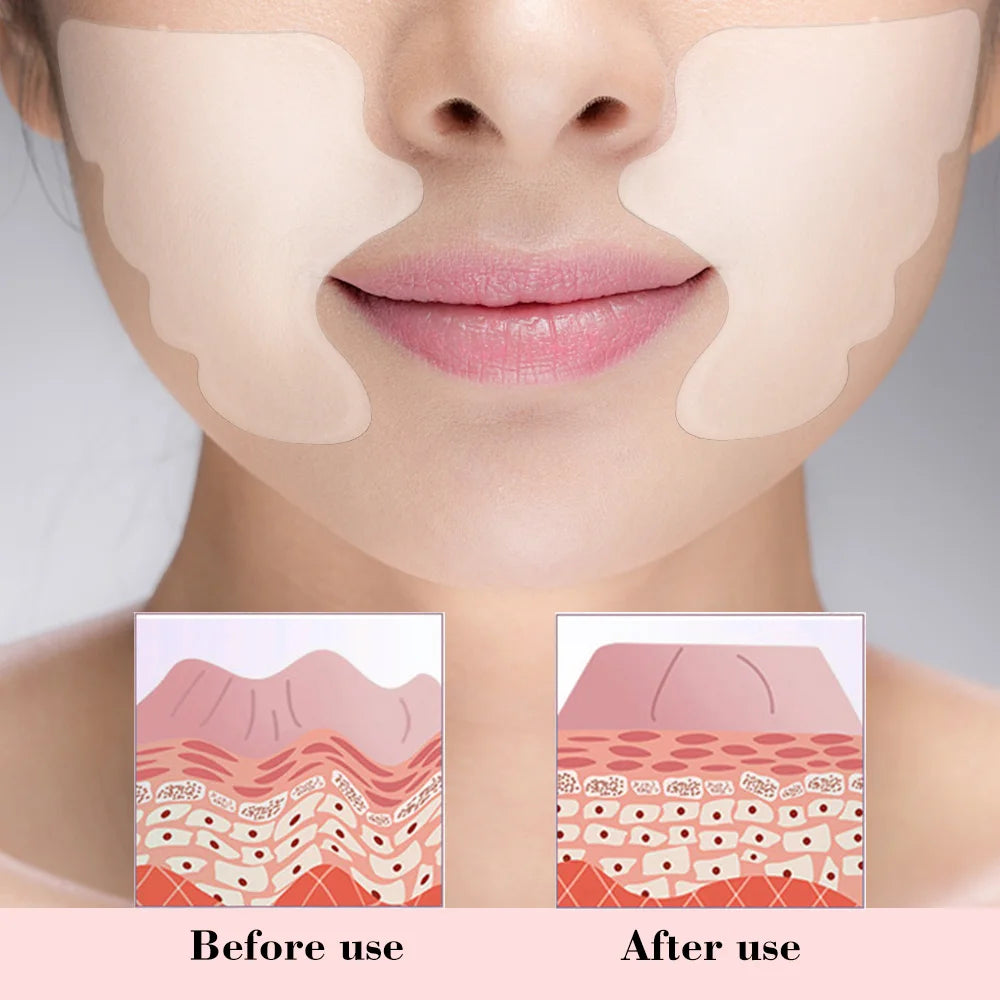 Almohadilla Antiarrugas de Silicona Reutilizable - Pliegues Nasolabiales y Lifting Facial
