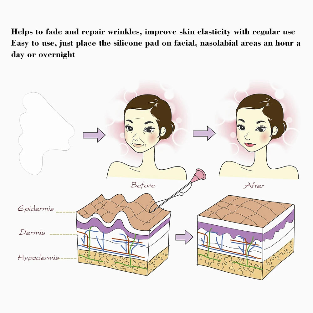 Almohadilla Antiarrugas de Silicona Reutilizable - Pliegues Nasolabiales y Lifting Facial